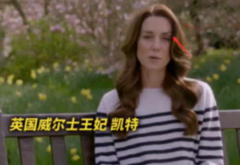 凯特王妃露面称患癌